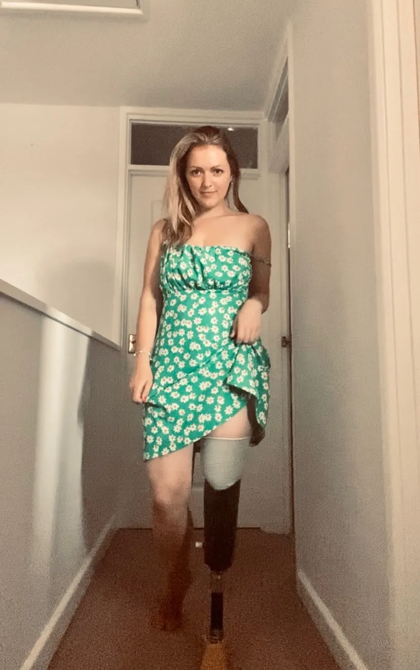 Amputee Bee OnlyFans